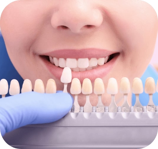 Closeup of smile compared with tooth colored filling