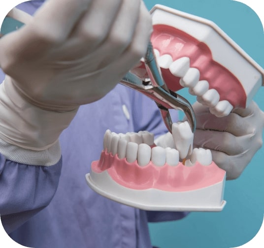 Dentist using model smile to demonstrate tooth extractions