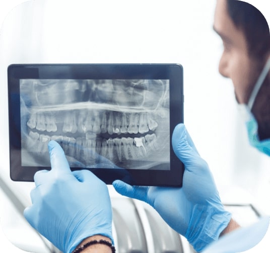 Digital x rays on chairside computer monitor