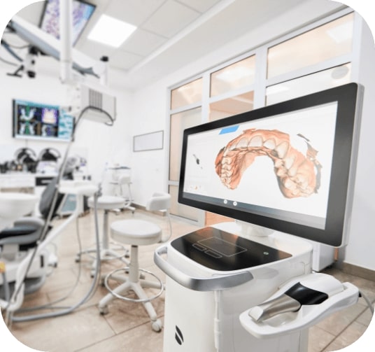 Digital bite impression system showing dental impressions